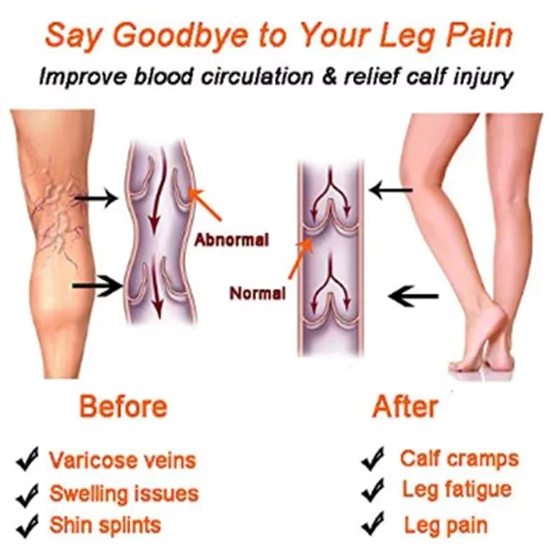 Women Compression Socks Slimmi - Compression Sock Medical ulasan dan harga